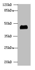 ALDOA Polyclonal Antibody (100 µl)