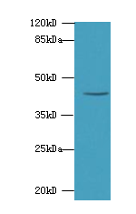 ALDOA Polyclonal Antibody