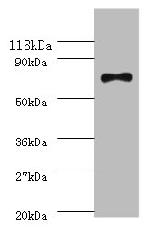 Western blot<br />All lanes: recQ Polyclonal Antibody at 2ug/ml+DH5a whole cell lysate<br />Secondary<br />Goat polyclonal to Rabbit IgG at 1/10000 dilution<br />Predicted band size: 68kDa<br />Observed band size: 68 kDa<br />