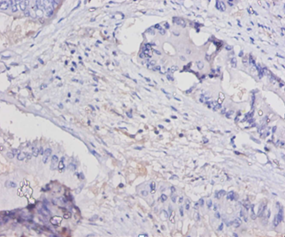IL15 Polyclonal Antibody