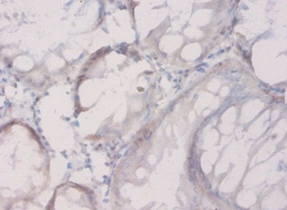 CTGF Polyclonal Antibody