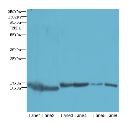 SOD1 Polyclonal Antibody