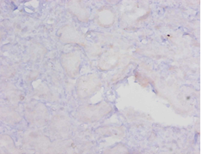 MGMT Polyclonal Antibody