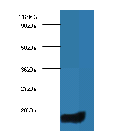 CCL5 Polyclonal Antibody
