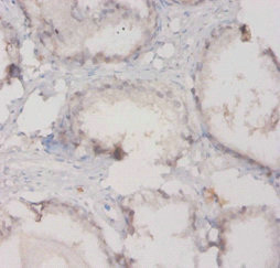 Immunohistochemistry of paraffin-embedded human prostate using C3 Polyclonal Antibody at dilution of 1:20