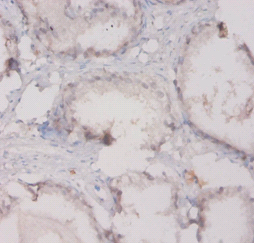 C3 Polyclonal Antibody