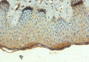Immunohistochemistry of paraffin-embeded human skin tissue at dilution of 1:100