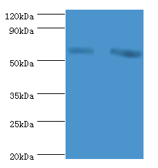 TROVE2 Polyclonal Antibody