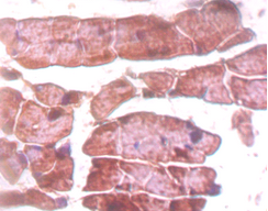 TTN Polyclonal Antibody
