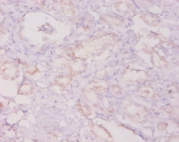 CSF3 Polyclonal Antibody