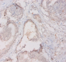 HLA-DQA2 Polyclonal Antibody