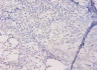 HLA-DQA1 Polyclonal Antibody