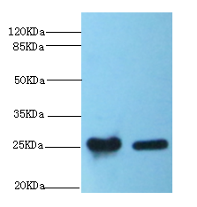 CRP Polyclonal Antibody