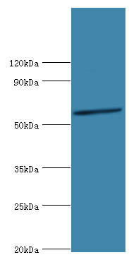 glpK Polyclonal Antibody