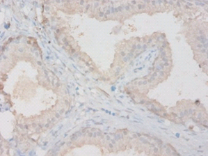 Mmp13 Polyclonal Antibody