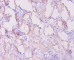 Bcl2 Polyclonal Antibody