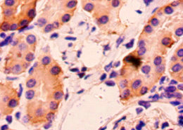 Immunohistochemistry of paraffin-embedded mouseidney using HAVCR2 Polyclonal Antibody at dilution 1:50