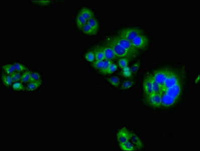 Immunofluorescent analysis of PC3 cells using HAVCR2 Polyclonal Antibody at a dilution of 1:100 and Alexa Fluor 488-congugated AffiniPure Goat Anti-Rabbit IgG (H+L)