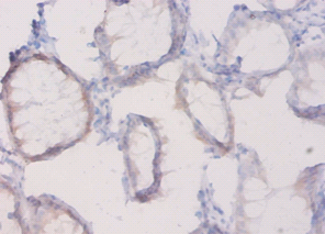 PLXNA1 Polyclonal Antibody