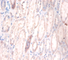 CDR2 Polyclonal Antibody