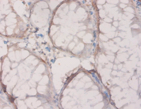 HPD Polyclonal Antibody
