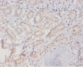 RAB10 Polyclonal Antibody