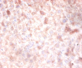 Immunohistochemistry of paraffin-embedded mouse liver using DNMT3A Polyclonal Antibody at dilution of 1:100