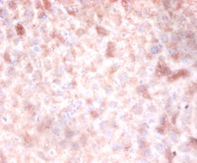 DNMT3A Polyclonal Antibody