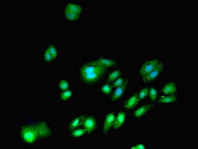 Immunofluorescent analysis of HepG2 cells using DNMT3A Polyclonal Antibody at a dilution of 1:100 and Alexa Fluor 488-congugated AffiniPure Goat Anti-Rabbit IgG (H+L)