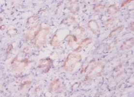 KCND1 Polyclonal Antibody