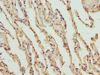 PROCR Polyclonal Antibody