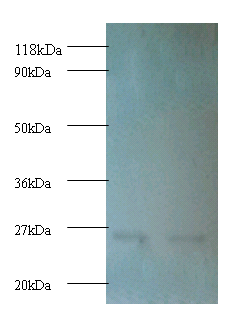 PSMB1 Polyclonal Antibody