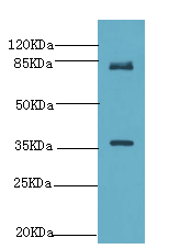 BDNF Polyclonal Antibody