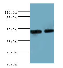 CALR Polyclonal Antibody