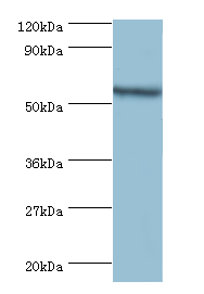 YARS Polyclonal Antibody