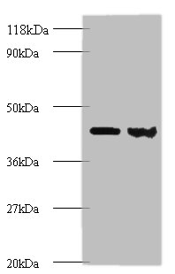 ARHGDIA Polyclonal Antibody (100 µl)