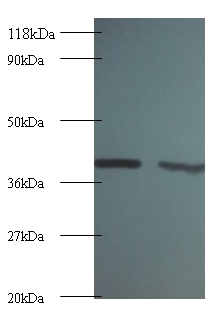 ARHGDIA Polyclonal Antibody