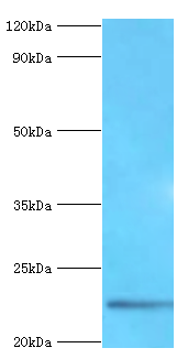 FGF21 Polyclonal Antibody