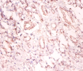 SNRPA Polyclonal Antibody