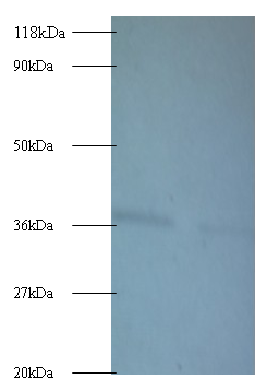 ATP5A1 Polyclonal Antibody
