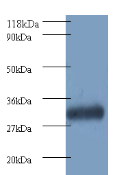 PSMB7 Polyclonal Antibody