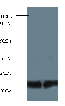 PSMB2 Polyclonal Antibody
