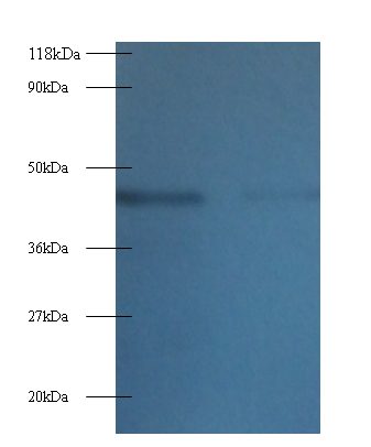 TTC1 Polyclonal Antibody