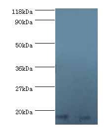 RPS16 Polyclonal Antibody