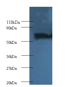 PSMB4 Polyclonal Antibody