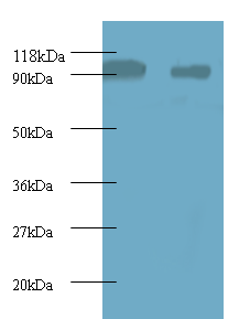 RPS12 Polyclonal Antibody