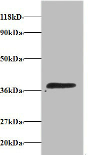 ATP6V1E1 Polyclonal Antibody (100 µl)