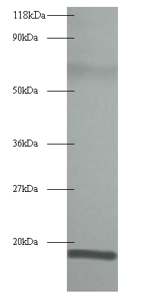 RPLP1 Polyclonal Antibody
