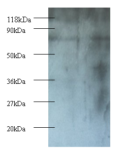 CSNK1E Polyclonal Antibody