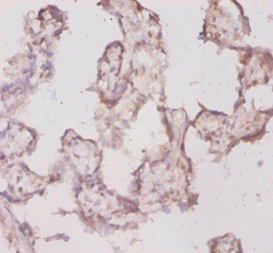 Tpt1 Polyclonal Antibody